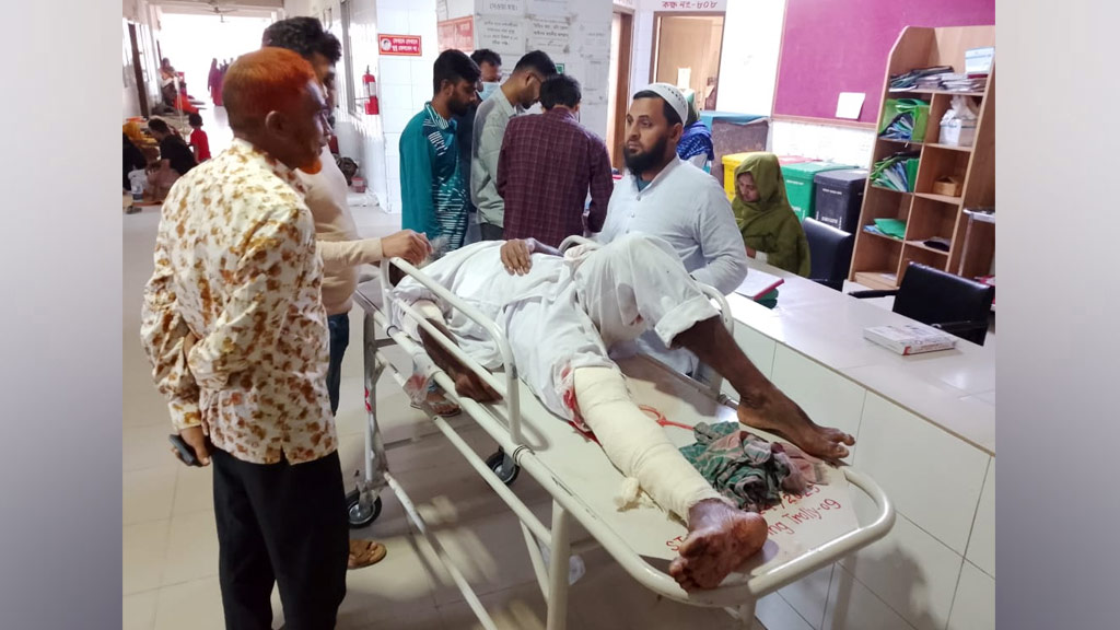 শ্রীপুরে মসজিদে যাওয়ার পথে জামায়াত নেতা কুপিয়ে আহত, দৃষ্টান্তমূলক শাস্তির দাবি